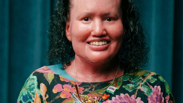 Carly Findlay, OAM Portrait of Carly Findlay, smiling and wearing a colourful floral top, in front of a teal curtain